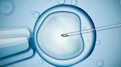 在正規的醫院做卵細胞捐贈者試管需要滿足什么標準？
